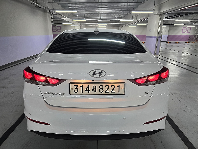 Hyundai AVANTE 2018 — фото осмотра 2
